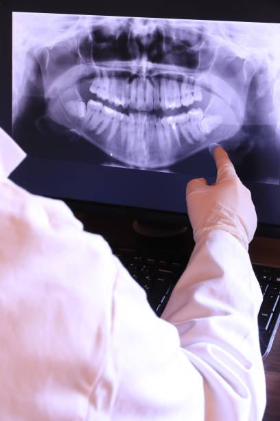 Best Emergency Dentist for Knocked-Out Tooth in Laguna Hills, CA